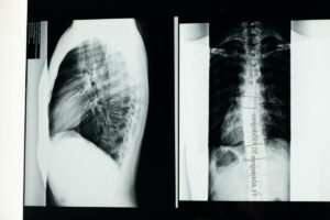 Prestazioni ambulatoriali, confermati i tetti di spesa nel 2026